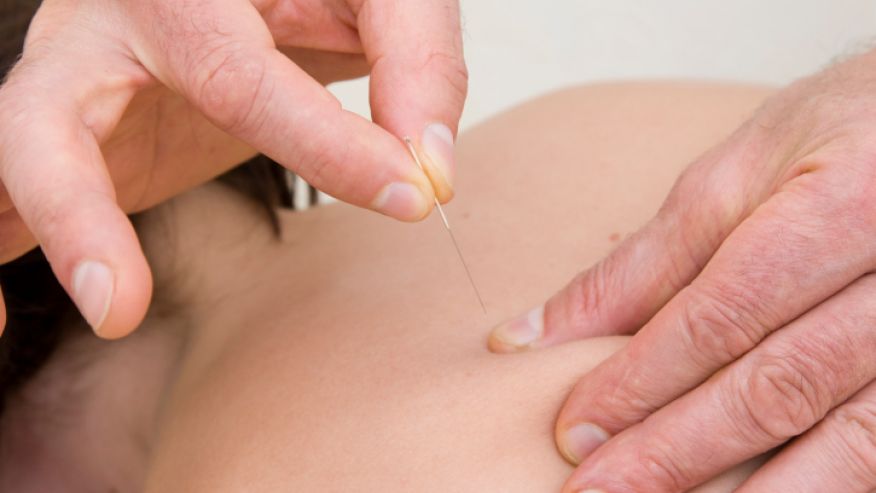 Acupuncturist: How Can Acupuncture Help Me to Get Better Faster After a Car Accident?